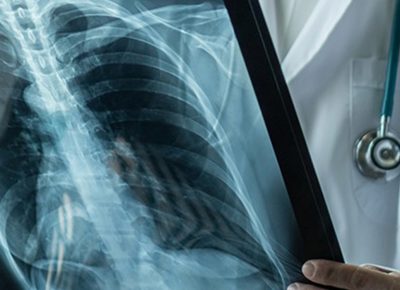 Return To Work Physicals Xray